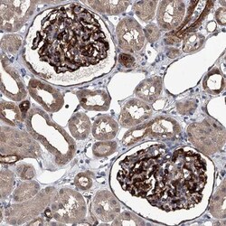 LDLRAD2 Antibody, Novus Biologicals:Antibodies:Primary Antibodies
