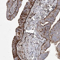 LDLRAD3 Antibody, Novus Biologicals 0.1 mL | Buy Online | Novus Biologicals | Fisher Scientific