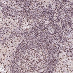 LDLRAD4 Antibody, Novus Biologicals 0.1mL; Unlabeled:Antibodies, Polyclonal