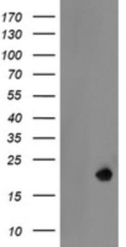 LDOC1 Antibody (OTI1A2), Novus Biologicals 0.1mL; Unlabeled:Antibodies,