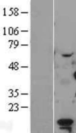 Novus Biologicals&trade;&nbsp;LDOC1 Overexpression Lysate