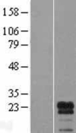 Novus Biologicals&trade;&nbsp;LDOC1L Overexpression Lysate