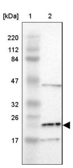 LDOC1L Antibody, Novus Biologicals 25 &mu;L; Unlabeled:Antibodies, Polyclonal