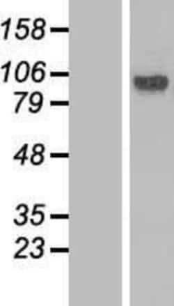 Novus Biologicals&trade;&nbsp;Lebercilin Overexpression Lysate
