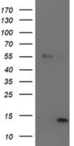 LECT2 Antibody (OTI2A11), Novus Biologicals 0.1mL; Unlabeled:Antibodies,