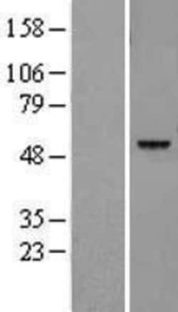 Novus Biologicals&trade;&nbsp;Legumain/Asparaginyl Endopeptidase Overexpression Lysate