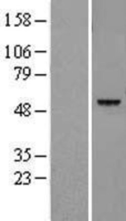 Novus Biologicals Legumain/Asparaginyl Endopeptidase Overexpression Lysate 0.1 mg | Buy Online | Novus Biologicals&trade; | Fisher Scientific
