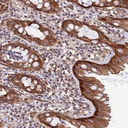 LEKR1 Antibody, Novus Biologicals 0.1mL; Unlabeled:Antibodies, Polyclonal