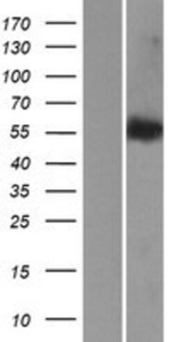 Novus Biologicals&trade;&nbsp;LEMD2 Overexpression Lysate