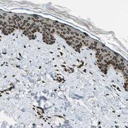 LEMD2 Antibody, Novus Biologicals 25ul | Buy Online | Novus Biologicals | Fisher Scientific