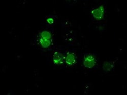 LEMD3 Antibody (OTI6C10), Novus Biologicals 0.1mL; Unlabeled:Antibodies,