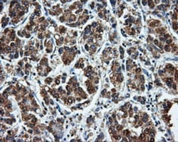 LEMD3 Antibody (OTI6C10), Novus Biologicals 0.1mL; Unlabeled:Antibodies,
