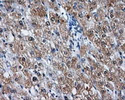LEMD3 Antibody (OTI6C10), Novus Biologicals 0.1mL; Unlabeled:Antibodies,