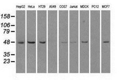 LEMD3 Antibody (OTI6C10), Novus Biologicals 0.1mL; Unlabeled:Antibodies,