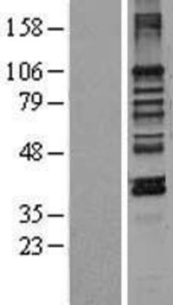 Novus Biologicals&trade;&nbsp;LEMD3 Overexpression Lysate