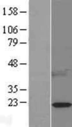 Novus Biologicals™ Leptin/OB Overexpression Lysate