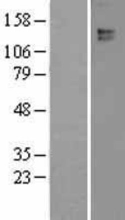 Novus Biologicals&trade;&nbsp;Leptin R Overexpression Lysate