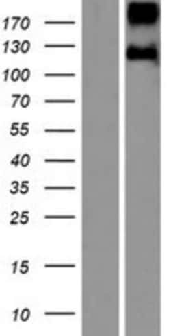 Novus Biologicals™ Leptin R Overexpression Lysate