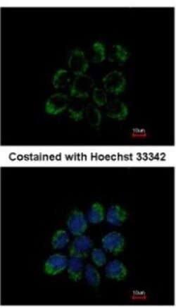 LETM1 Antibody, Novus Biologicals 100 ul; Unconjugated:Antibodies, Polyclonal