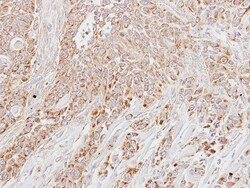 LETM1 Antibody, Novus Biologicals 100 ul; Unconjugated:Antibodies, Polyclonal