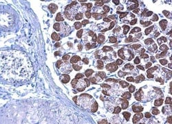 LETM1 Antibody, Novus Biologicals 100 ul; Unconjugated:Antibodies, Polyclonal