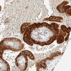 LETM2 Antibody, Novus Biologicals 25 &mu;L; Unlabeled:Antibodies, Polyclonal