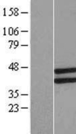 Novus Biologicals&trade;&nbsp;LETMD1 Overexpression Lysate