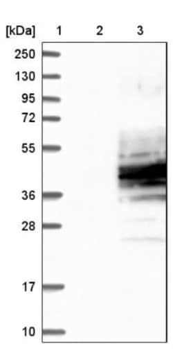Leukotriene B4 R1 Antibody, Novus Biologicals 25 &mu;L | Buy Online | Novus Biologicals | Fisher Scientific