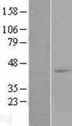 Novus Biologicals&trade;&nbsp;Leukotriene B4 Receptor 2 Overexpression Lysate