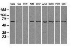 Leukotriene A4 Hydrolase/LTA4H Antibody (OTI1E9), Novus Biologicals 0.1mL;