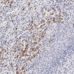 Leukotriene B4 R1 Antibody, Novus Biologicals 25 &mu;L | Buy Online | Novus Biologicals | Fisher Scientific