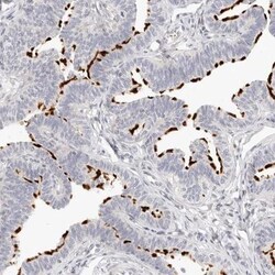 Leukotriene B4 Receptor 2 Antibody, Novus Biologicals 0.1mL; Unlabeled:Antibodies,