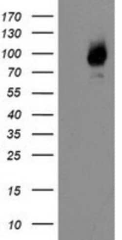 Galectin-3BP/MAC-2BP/LGALS3BP Antibody (OTI6B7), Novus Biologicals 0.1mL;