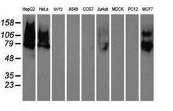 Galectin-3BP/MAC-2BP/LGALS3BP Antibody (OTI6B7), Novus Biologicals 0.1mL;