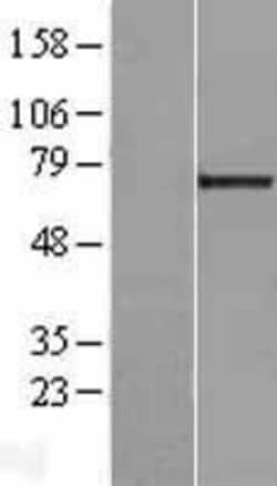 Novus Biologicals&trade;&nbsp;Galectin-3BP/MAC-2BP/LGALS3BP Overexpression Lysate