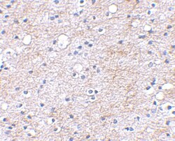 Lgi1 Antibody - BSA Free, Novus Biologicals 0.1mg; Unlabeled:Antibodies,