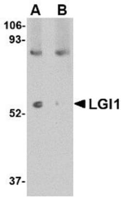 Lgi1 Antibody - BSA Free, Novus Biologicals 0.025 mg, Unconjugated:Antibodies,