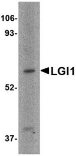 Lgi1 Antibody - BSA Free, Novus Biologicals 0.1mg; Unlabeled:Antibodies,