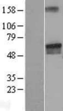 Novus Biologicals&trade;&nbsp;LGI2 Overexpression Lysate
