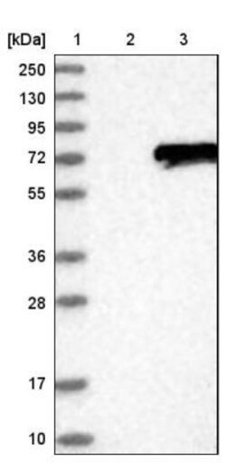 LGI2 Antibody, Novus Biologicals 0.1mL; Unlabeled:Antibodies, Polyclonal