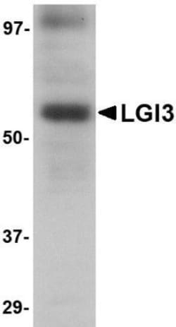 Lgi3 Antibody - BSA Free, Novus Biologicals 0.1mg; Unlabeled:Antibodies,