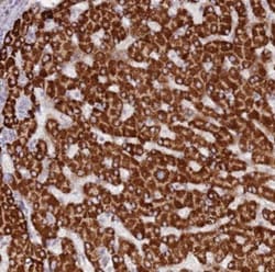 Lgi4 Antibody, Novus Biologicals:Antibodies:Primary Antibodies