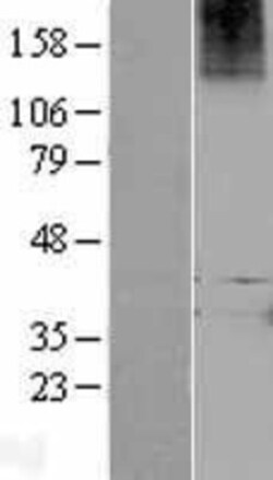 Novus Biologicals&trade;&nbsp;Relaxin R1/LGR7 Overexpression Lysate