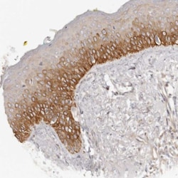 Relaxin R1/LGR7 Antibody, Novus Biologicals:Antibodies:Primary Antibodies