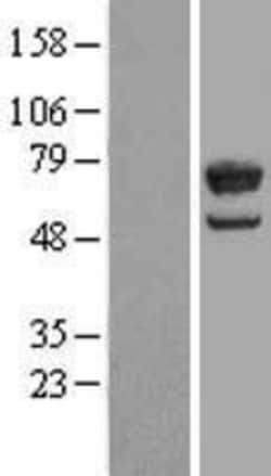 Novus Biologicals&trade;&nbsp;LGTN Overexpression Lysate