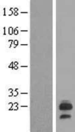 Novus Biologicals&trade;&nbsp;LHFP Overexpression Lysate
