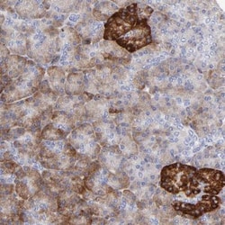 LHFPL1 Antibody, Novus Biologicals 25 &mu;L; Unlabeled:Antibodies, Polyclonal