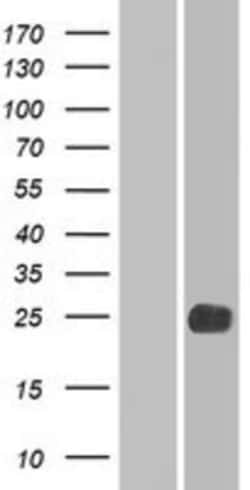 Novus Biologicals™ LHFPL2 Overexpression Lysate