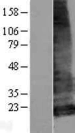 Novus Biologicals™ LHFPL5 Overexpression Lysate
