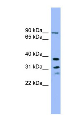 LHPP Antibody, Novus Biologicals 100 &mu;L | Buy Online | Novus Biologicals | Fisher Scientific